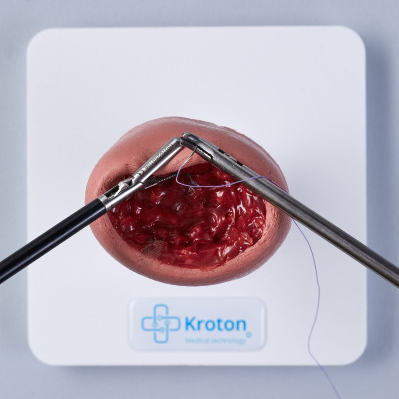 Fibroidectomy skills practising Fibroidectomy skills practising