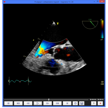 baza danych echokardiografia