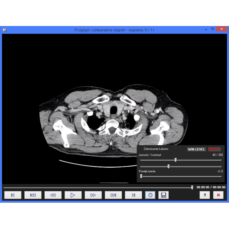 baza danych mri ct baza danych mri ct
