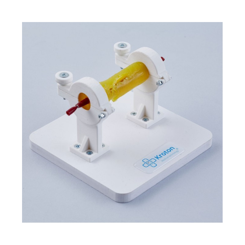 laparoscopic preparation of vessel laparoscopic preparation of vessel