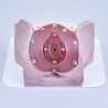 Die Anastomose nach radikaler Prostatektomie (URO001)