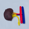 Kidney – model for partial nephrectomy procedure  (LAP033)